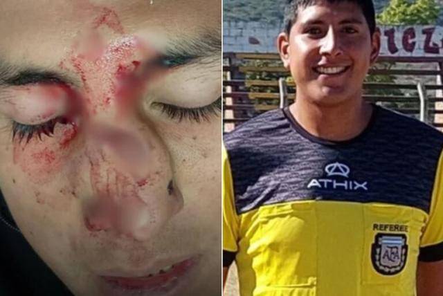 Brutal agresión a un árbitro en Salta