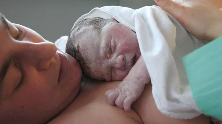 Altas tasas de cesáreas en Argentina