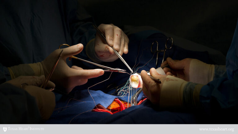 Crisis en Salud: Advierten sobre Escasez de Stents y Angioplastias