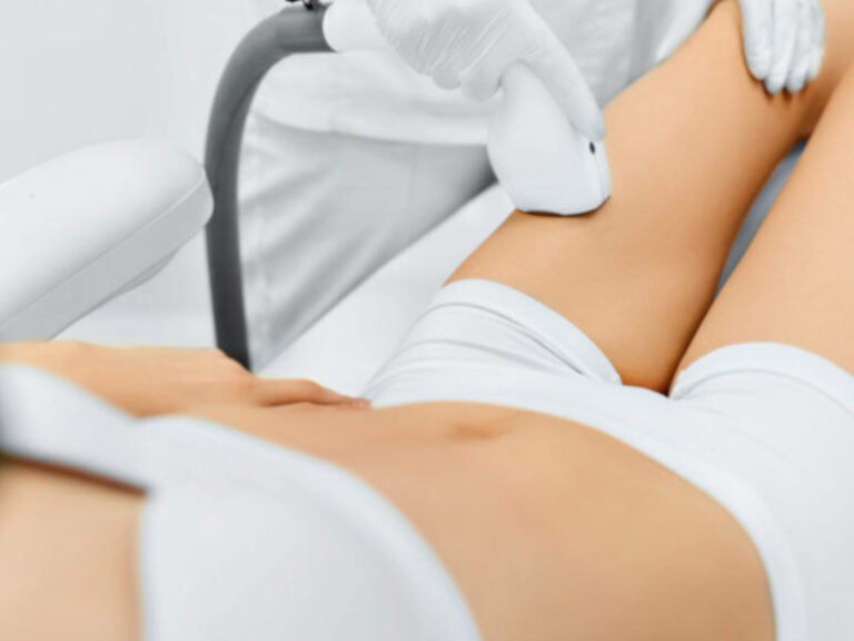 Depilación Infrared