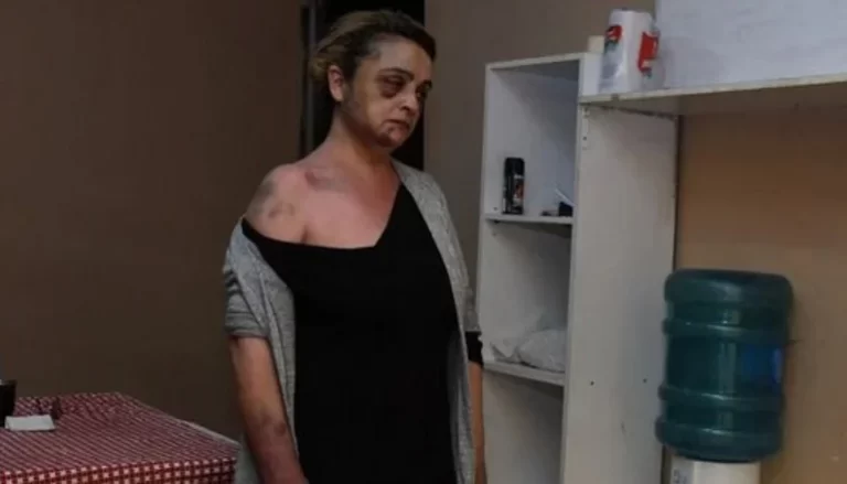 “Vivo con miedo”: Fernanda Damico exige la captura de su agresor prófugo