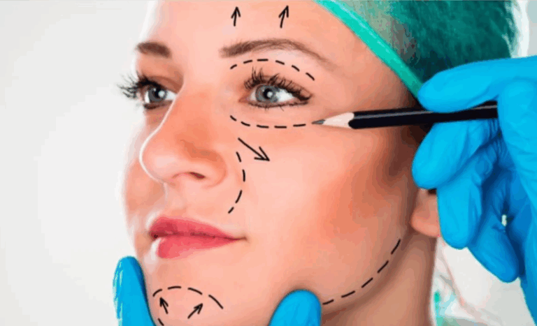 Rejuvenecimiento facial antes de los 40: ¿Por qué crece esta tendencia en Argentina?