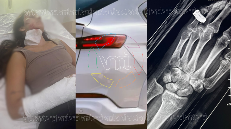 La hija de una ex legisladora atropelló a una mujer y habría intentado fugarse