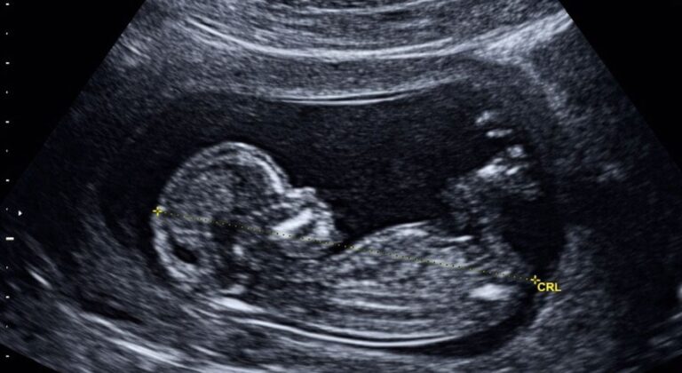 San Luis: histórica adopción permitió que un bebé fuera entregado a su familia antes de nacer